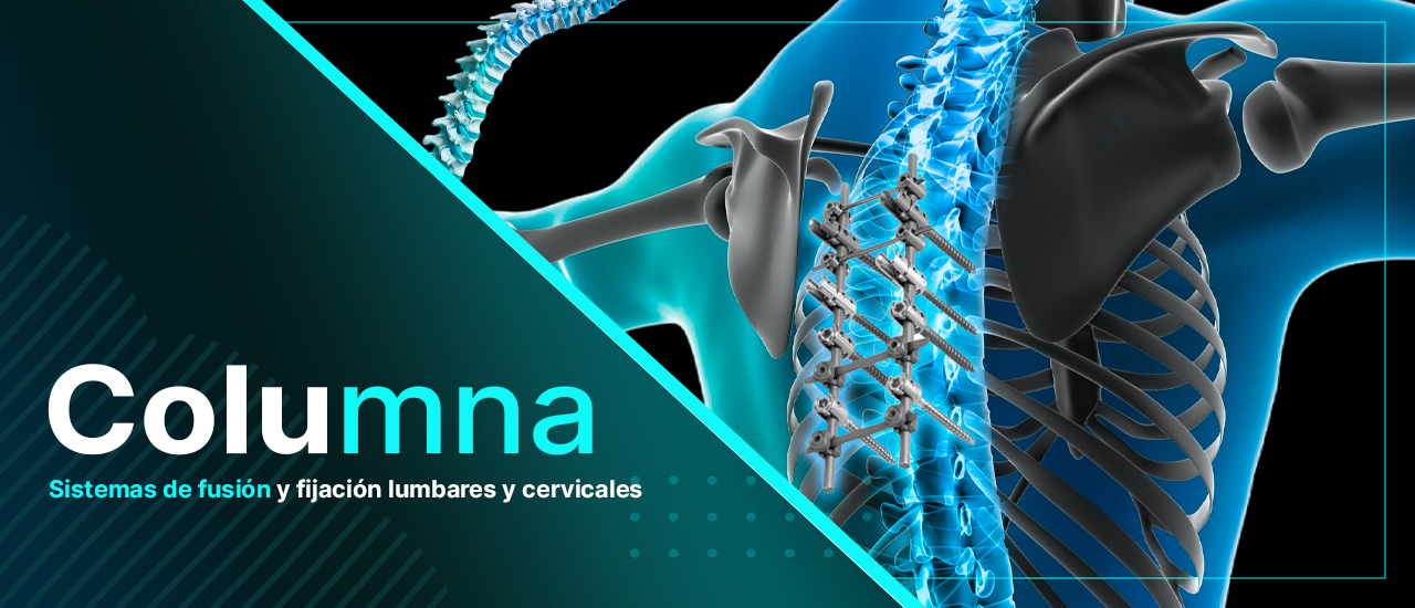 banner columna