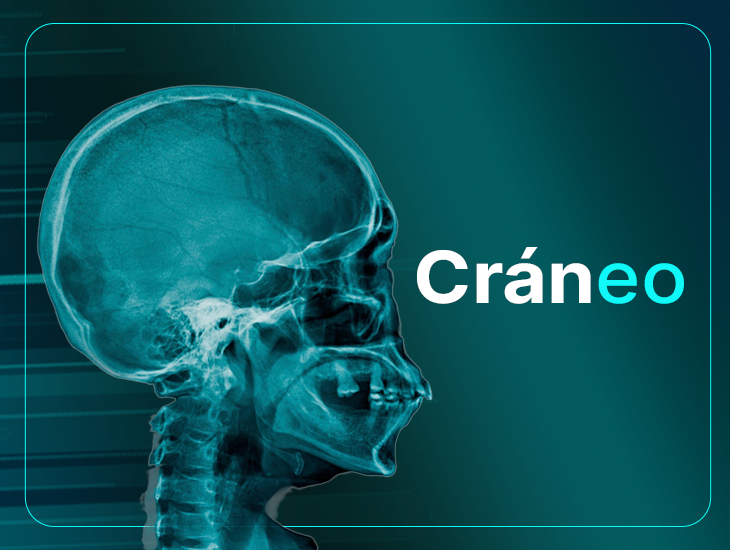 craneo