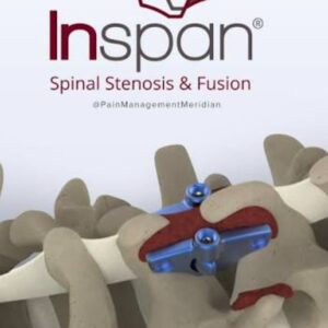 Inspan, Estenosis Espinal y Fusión, Fijación Interespinosa e Interlaminar